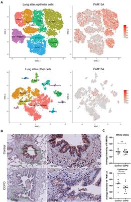 A Protective Role of FAM13A in Human Airway Epithelial Cells Upon Exposure to Cigarette Smoke Extract